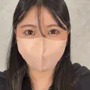 二重埋没 アリエル美容クリニック 横浜院 DAY 11 サムネイル用