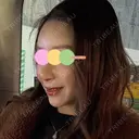 糸リフト / 脂肪吸引（顔） / 額を丸く / 脂肪注入（額） / メーラーファット除去 / ジョールファット除去 / 脂肪注入（輪郭） WOM CLINIC GINZA （ワム クリニック ギンザ） DAY 30 サムネイル用