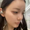オンダリフト HAAB CLINIC 池袋院 DAY 14 サムネイル用