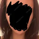 デンシティ 城本クリニック 新宿院 DAY 8 サムネイル用