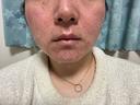 ポテンツァ ルラ美容クリニック 岐阜院 DAY 0 サムネイル用