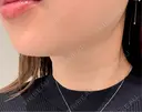 オンダリフト RIVER CLINIC（リバークリニック） AFTER サムネイル用