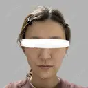脂肪注入（額） / ボトックス（あご） / ヒアルロン酸注入（唇） / 脂肪注入（輪郭） アリエル美容クリニック 大宮院 DAY 56 サムネイル用