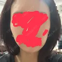 デンシティ 城本クリニック 新宿院 DAY 13 サムネイル用