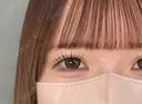二重埋没 アリエル美容クリニック 大宮院 DAY 8 サムネイル用