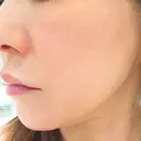 美容点滴・美容注射（美肌） / 美容点滴・美容注射（疲労回復） / ピーリング（ニキビ・毛穴） / イオン導入 / エレクトロポレーション / ピーリング（ハリ・ツヤ） oneUPclinic AFTER サムネイル用