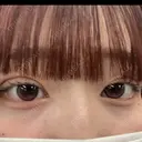 二重埋没 アリエル美容クリニック 郡山院 DAY 3 サムネイル用