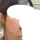 インモード 小倉美容外科/美容皮膚科 ビラビューティークリニック DAY 0 サムネイル用