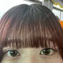 二重埋没 アリエル美容クリニック 郡山院 DAY 4 サムネイル用