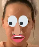 インモード PureMe Skin Clinic（ピュアミースキンクリニック麻布） AFTER サムネイル用