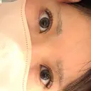 二重埋没 恵聖会クリニック 京橋院 DAY 10 サムネイル用
