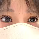 二重埋没 恵聖会クリニック 京橋院 DAY 11 サムネイル用