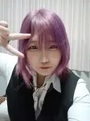 糸リフト / 脂肪吸引注射（顔） EMMO FACE CLINIC 大阪梅田院 AFTER サムネイル用