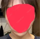 インモード BE ONE CLINIC AFTER サムネイル用