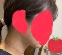インモード BE ONE CLINIC DAY 0 サムネイル用