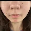 ルメッカ ルラ美容クリニック 名古屋栄院 / ルラスキンクリニック 名古屋栄院 AFTER サムネイル用