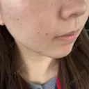 ルメッカ ルラ美容クリニック 名古屋栄院 / ルラスキンクリニック 名古屋栄院 DAY 2 サムネイル用