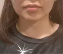 オンダリフト RIVER CLINIC（リバークリニック） AFTER サムネイル用
