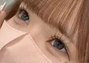 二重埋没 アリエル美容クリニック 大宮院 AFTER サムネイル用