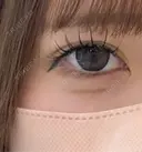 二重埋没 アリエル美容クリニック 大宮院 DAY 31 サムネイル用