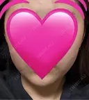 インモード ARTE BEAUTY CLINIC DAY 0 サムネイル用
