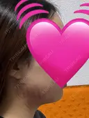 インモード ARTE BEAUTY CLINIC DAY 0 サムネイル用