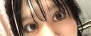 二重埋没 アリエル美容クリニック 郡山院 DAY 13 サムネイル用