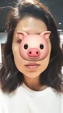 ハイフ（顔） CLASSY 仙台美容外科・美容皮膚科 DAY 1 サムネイル用