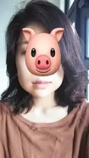 ハイフ（顔） CLASSY 仙台美容外科・美容皮膚科 DAY 2 サムネイル用