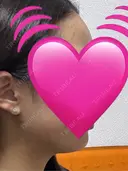 インモード ARTE BEAUTY CLINIC DAY 3 サムネイル用