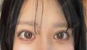二重埋没 アリエル美容クリニック 郡山院 DAY 20 サムネイル用