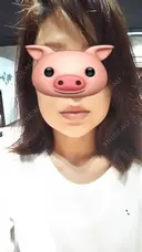 ハイフ（顔） CLASSY 仙台美容外科・美容皮膚科 DAY 6 サムネイル用