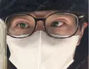 二重埋没 ルラ美容クリニック 仙台院 / ルラスキンクリニック 仙台院 DAY 0 サムネイル用