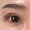 タレ目形成・グラマラスライン（埋没） Olino美容外科・美容皮膚科 DAY 8 サムネイル用
