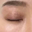 タレ目形成・グラマラスライン（埋没） Olino美容外科・美容皮膚科 DAY 8 サムネイル用