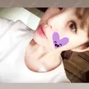 ヒアルロン酸注入（鼻） / ヒアルロン酸注入（頬） 銀座国際美容外科 池袋院 AFTER サムネイル用