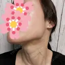 ルメッカ / インモード Moon Beauty Clinic DAY 3 サムネイル用