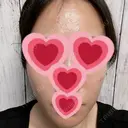 ルメッカ / インモード Moon Beauty Clinic DAY 3 サムネイル用