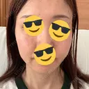 水光注射（ハリ・美肌） Chloe Cheongdam Clinic （クロエチョンダムクリニック） DAY 1 サムネイル用