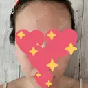 ルメッカ / インモード Moon Beauty Clinic DAY 4 サムネイル用