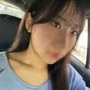 二重埋没 湘南美容クリニック 大阪梅田本院 DAY 2 サムネイル用