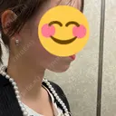 ハイフ（顔） HINATA クリニック DAY 0 サムネイル用