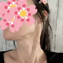 ルメッカ / インモード Moon Beauty Clinic DAY 15 サムネイル用