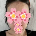 ルメッカ / インモード Moon Beauty Clinic DAY 15 サムネイル用
