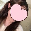 糸リフト / 脂肪吸引（顔） ネビュラクリニック 東京錦糸町院 AFTER サムネイル用