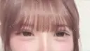 二重埋没 / 上まぶたの脂肪取り アリエル美容クリニック 郡山院 DAY 22 サムネイル用