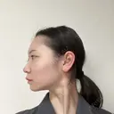 鼻尖形成（切開） / 小鼻縮小（切開） / 軟骨移植 / 鼻尖縮小 / 鼻孔縁下降 アリエル美容クリニック 郡山院 DAY 28 サムネイル用