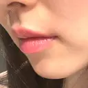 ヒアルロン酸注入（唇） PRO CLINIC プロクリニック 銀座院 DAY 0 サムネイル用