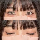 二重埋没 / 目頭切開 / 上まぶたの脂肪取り アリエル美容クリニック 郡山院 AFTER サムネイル用