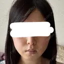 糸リフト / バッカルファット除去 / 脂肪吸引（顔） / ネックリフト / ヒアルロン酸注入（あご） / ボトックス（エラ・小顔） / ヒアルロン酸注入（唇） / ヒアルロン酸注入（鼻翼基部） / ヒアルロン酸注入（ほうれい線） HAAB×DREAM BEAUTY CLINIC 東京本院 DAY 10 サムネイル用